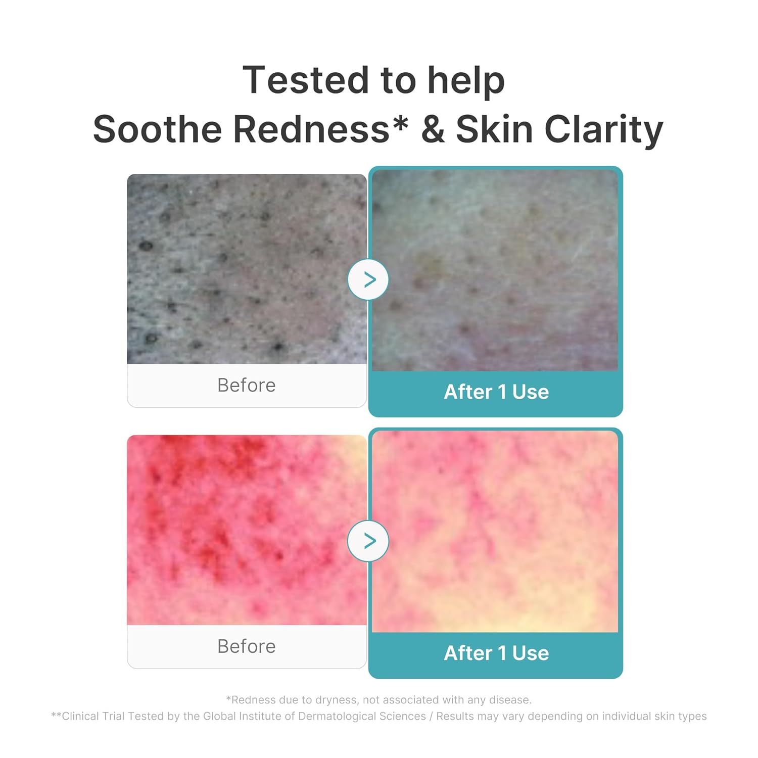 Medicube Facial Cleanser Zero Pore Capsule Cleansing Foam with gentle foaming texture for deep pore cleansing.