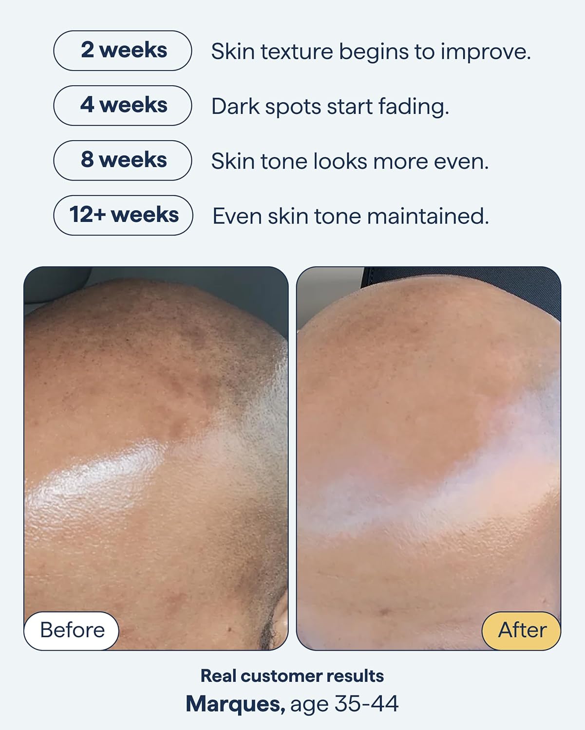 Remedy Science Advanced Night Treatment for dark spots, featuring a sleek bottle with a dropper for targeted skincare.