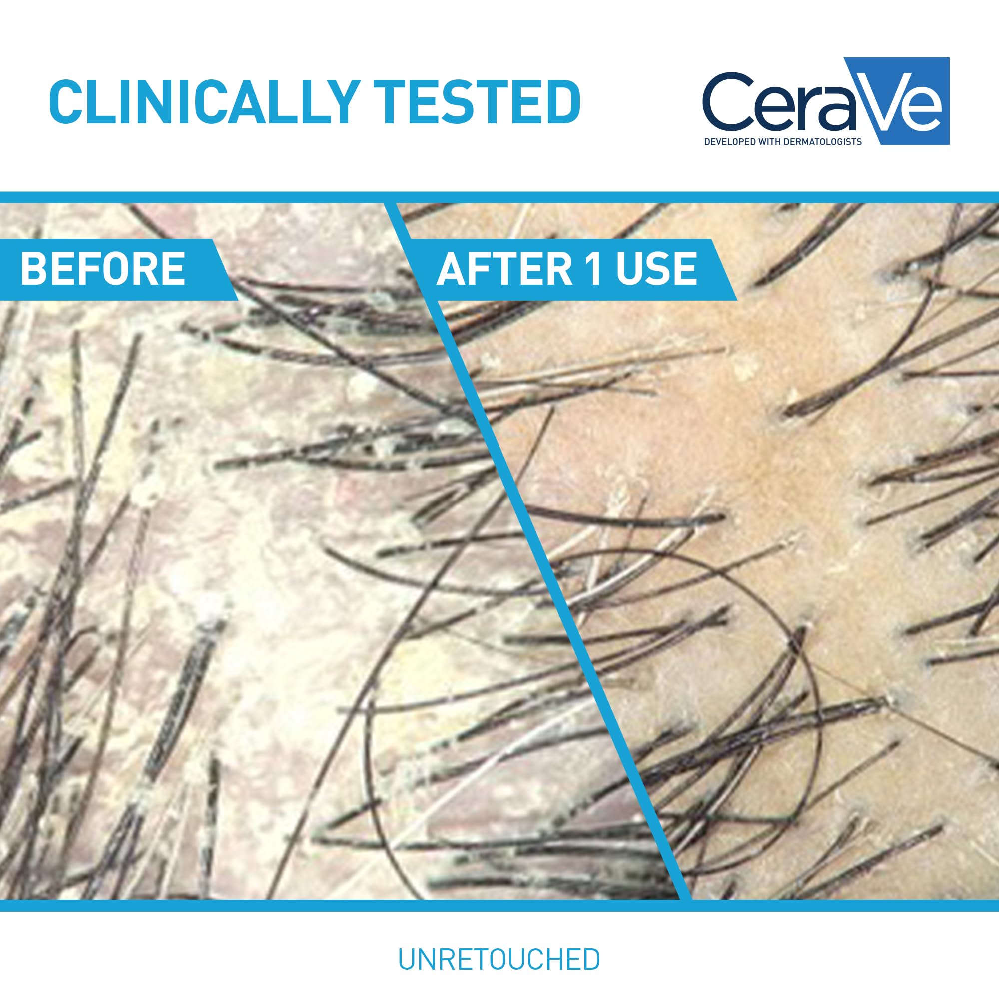 CeraVe Hydrating Anti Dandruff Shampoo bottle with label, featuring a clear liquid inside, designed to soothe scalp and hydrate hair.