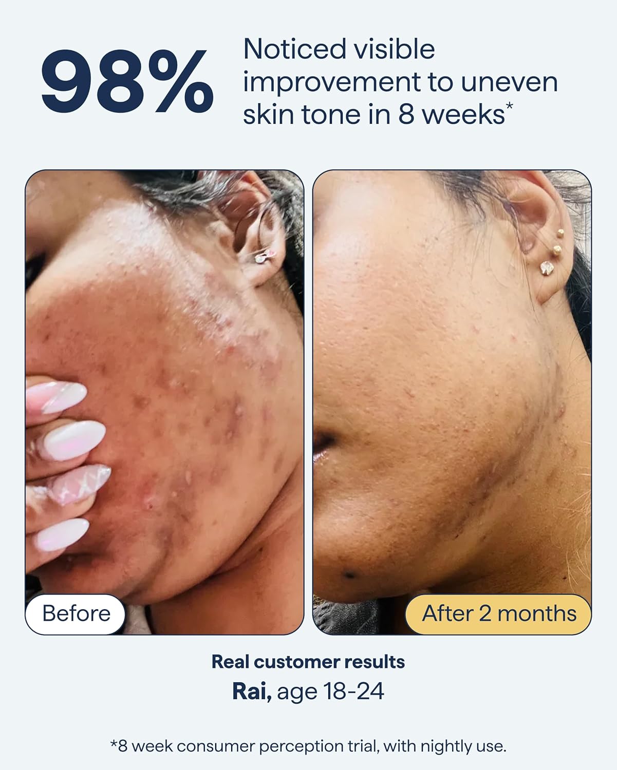 Remedy Science Advanced Night Treatment for dark spots, featuring a sleek jar with the product label and a smooth skincare container.