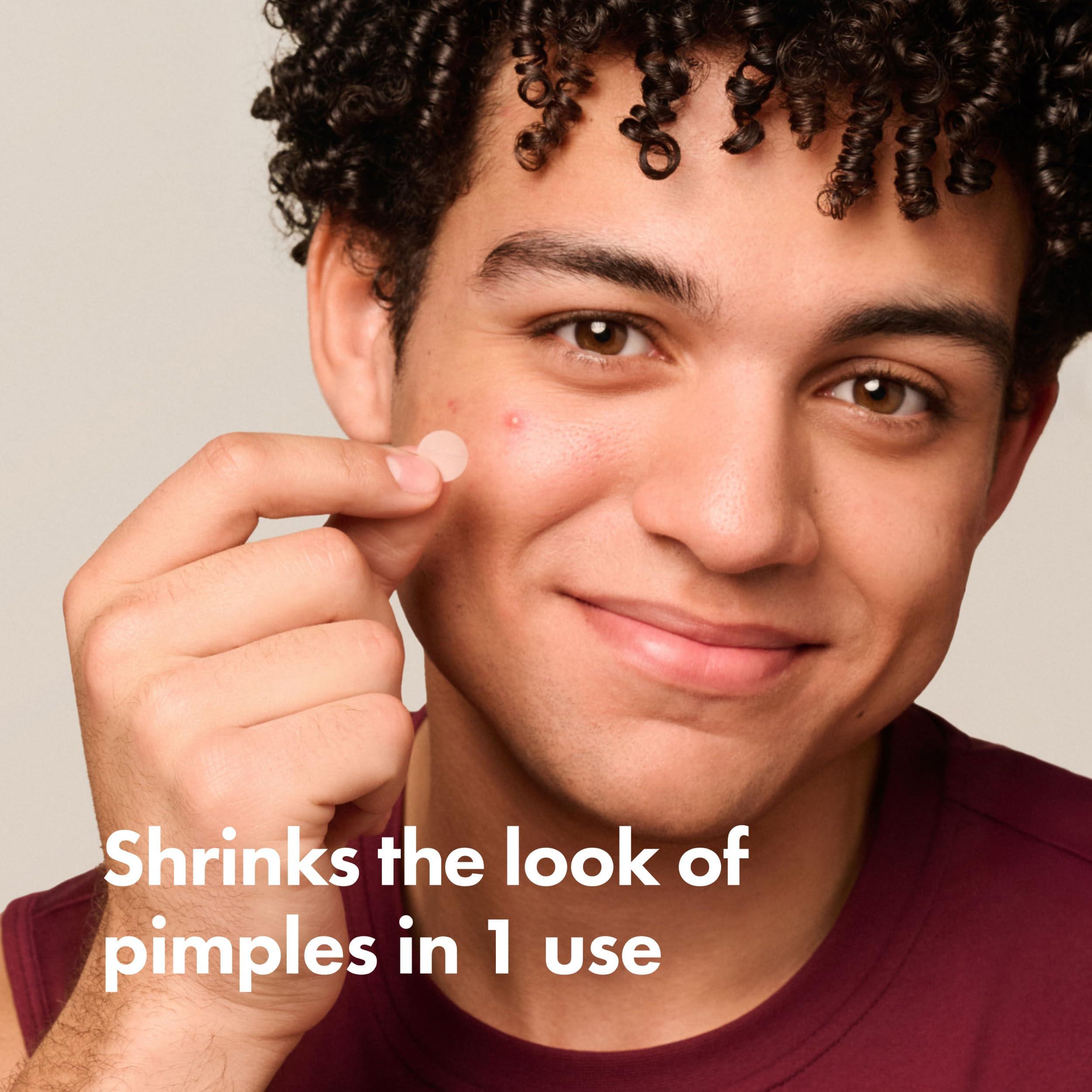 Matchy Patch Mighty Patch Original acne treatment patch on skin, clear and discreet blemish healing sticker.