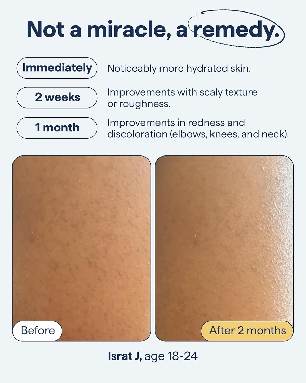 Remedy Science Body Bumps treatment bottle with applicator for soothing skin irritation and bumps.